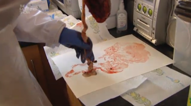 plaprint